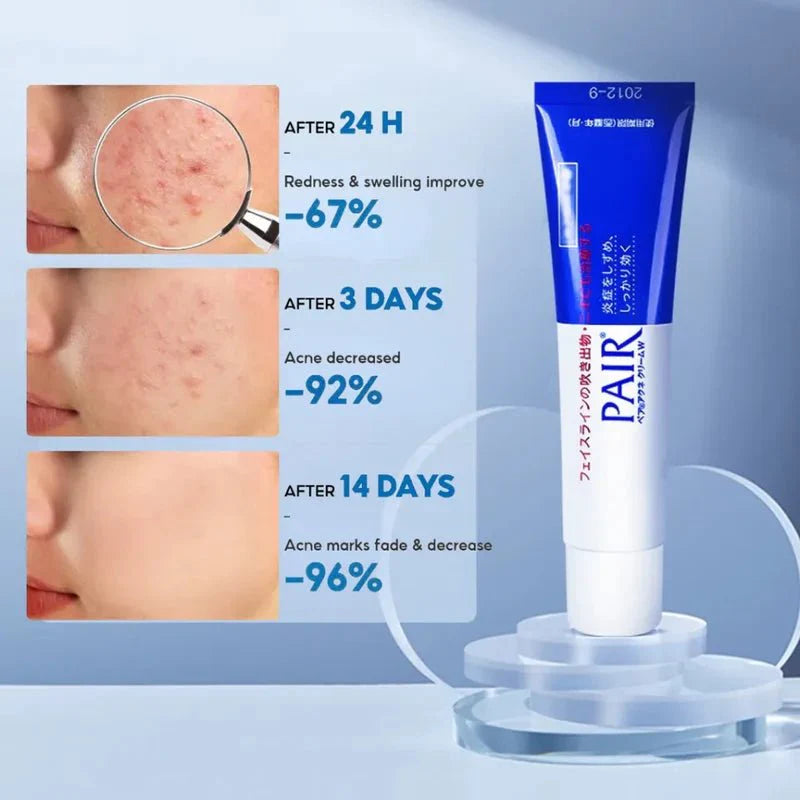 Pair Acne Cream W (crema para brotes) - Koelleza Store